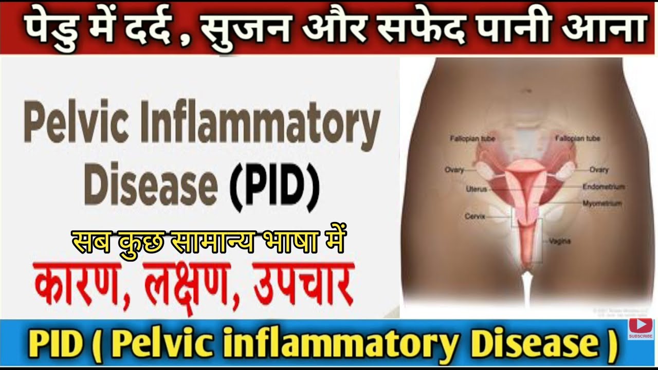 PID infection kya hota hai | Pelvic inflammatory in hindi, pid, pid hindi @medstarhealthcare786
